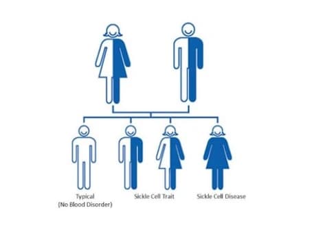 Sickle cell trait