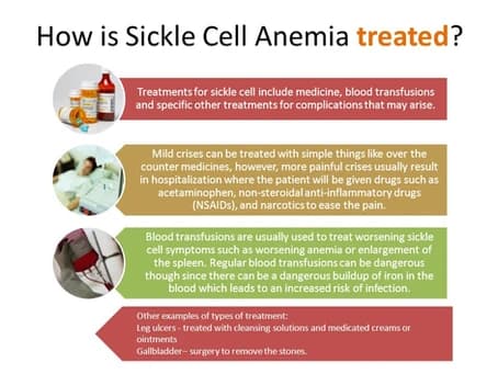 HOW SICKLE CELL ANEMIA IS TREATED.