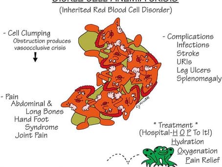 SICKLE CELL ANEMIA CRISES