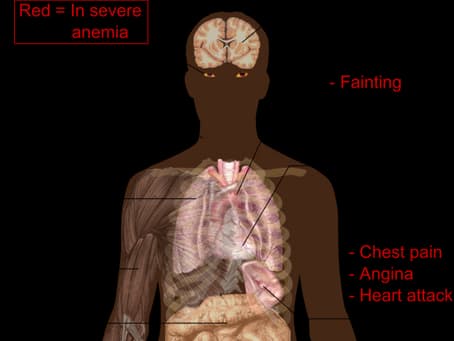 THE SYMPTOMS OF ANEMIA